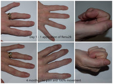 Load image into Gallery viewer, Revitalising Renu28 Gel – All-Over Skin Support (90ml)