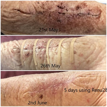 Load image into Gallery viewer, Revitalising Renu28 Gel – All-Over Skin Support (90ml)