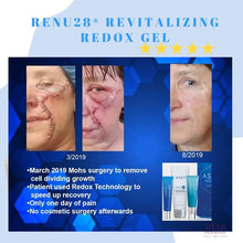 Load image into Gallery viewer, Revitalising Renu28 Gel – All-Over Skin Support (90ml)