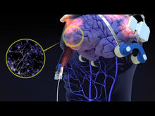 Load and play video in Gallery viewer, Vielight SOI | Infrared Energy & Photobiomodulation System (Quantum Light for WholeBody Healing)