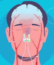 Load image into Gallery viewer, Vielight SOI | Infrared Energy & Photobiomodulation System (Quantum Light for WholeBody Healing)