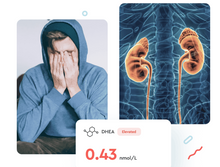 Load image into Gallery viewer, Adrenal Fatigue Test (Cortisol &amp; DHEA)
