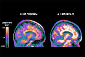 Pre and Post Menopause Profile