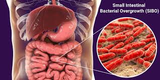 Gut Test - SIBO Test UK - Hydrogen Methane Breath Analysis